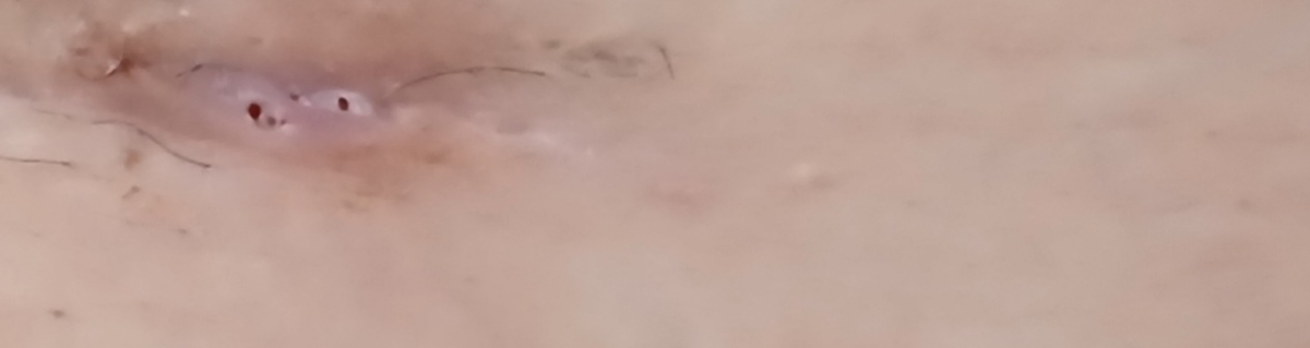 عاطی الان اینه🥺 عاطی الان اینه🥺