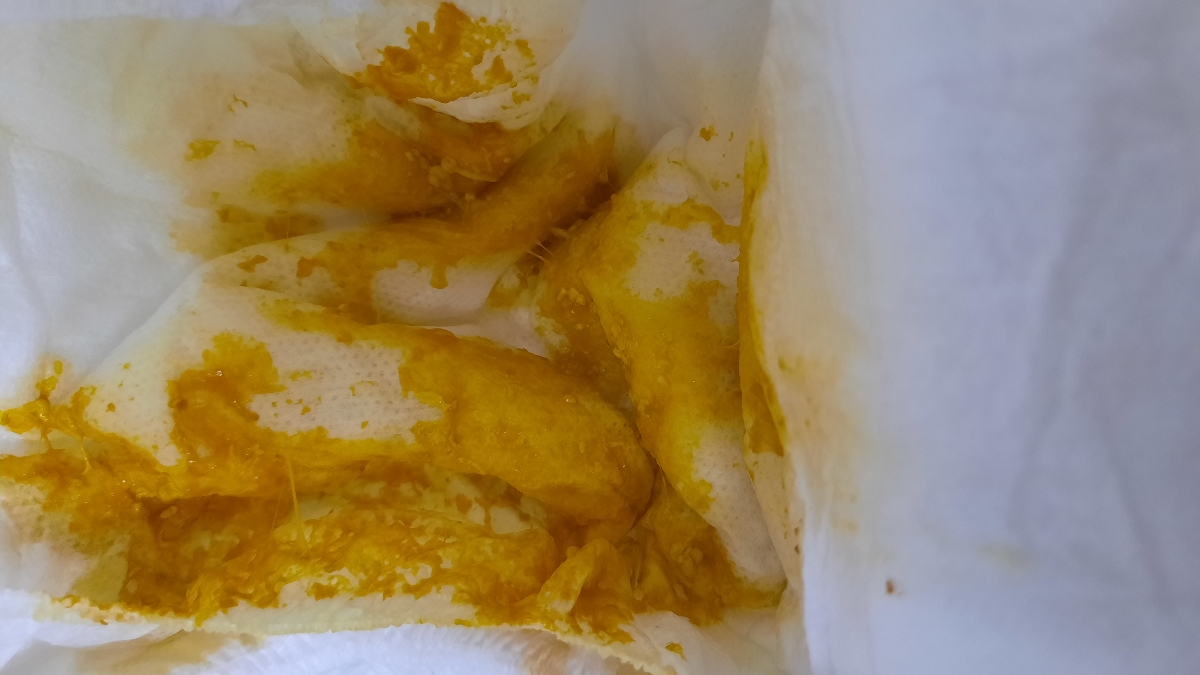 ببخشید
الان این مدفوع دخترم خلط دار هست؟؟ ببخشید
الان این مدفوع دخترم خلط دار هست؟؟