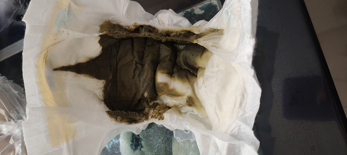 با عرض معذرت
این دفع الان با عرض معذرت
این دفع الان