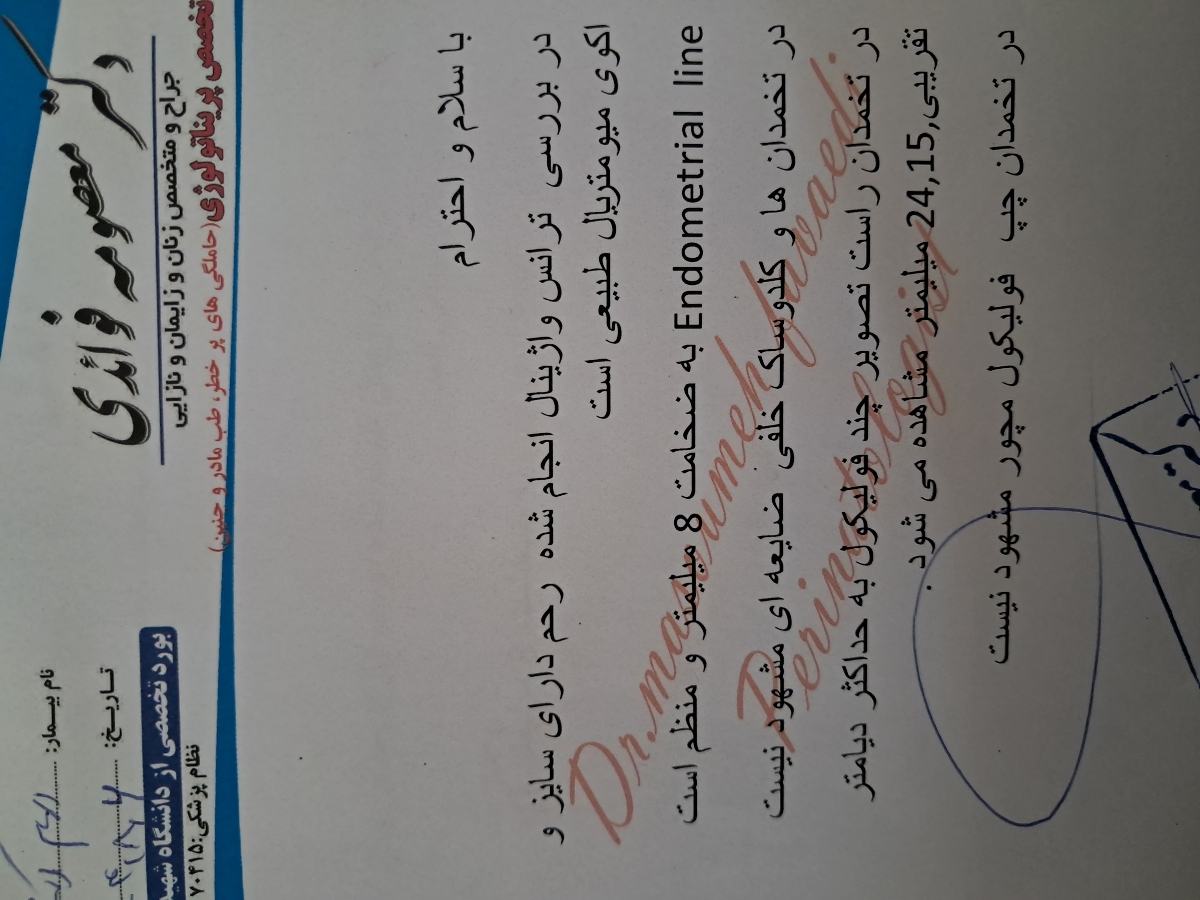 ماه سوم ۱۵ تا لترازول و ۵تا سینال اف در روزهای ۷تا۱۱ برگه سنو روز ۱۱ میباشد من روز ده درد شدید و حس جرقه درتخمدان چپ داشتم بعدش ترشح تخم مرغی که دکتر گفت احتمالا فولی ازاد شده مایع هم جدب شده