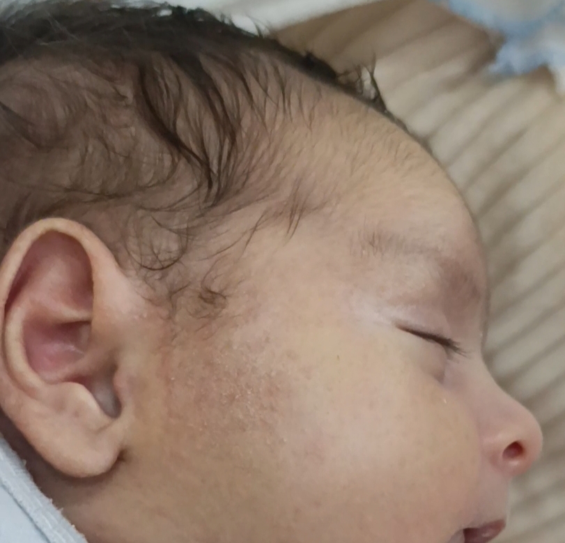 ایا این دونه ها حساسیت به پروتین گاوی هست