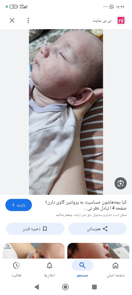 ایا این دونه ها حساسیت به پروتین گاوی هست