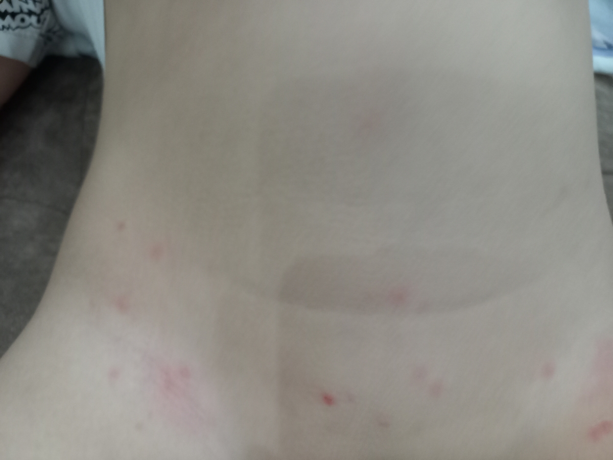 دخترم خیلی سرفه میکنی .انقدر شدیده دخترم خیلی سرفه میکنی .انقدر شدیده