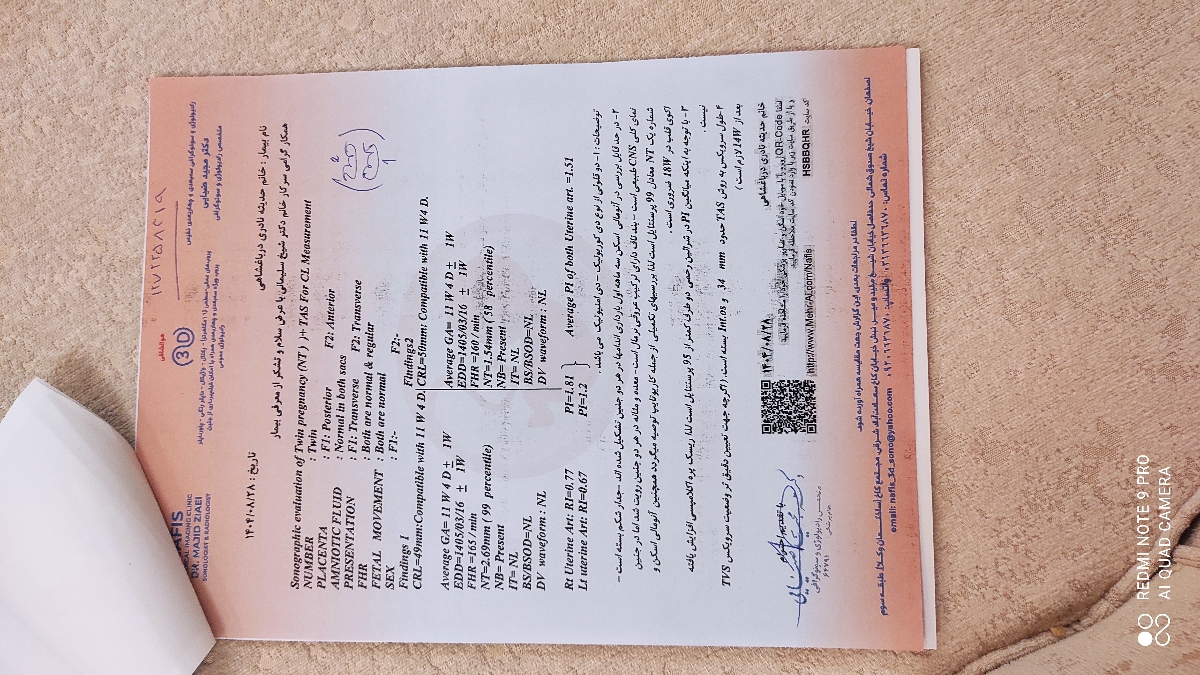 سلام خانم دکتر لطفاً بهم بگید nt قل اول من مشکوک هست؟