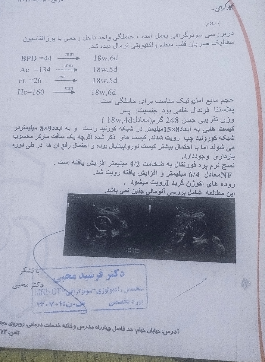 سونوگرافی دوم