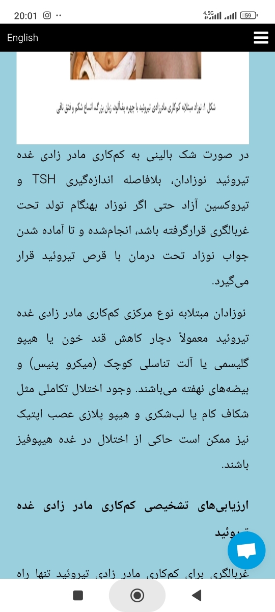تیرویید لب مرز و میکرو پنیس بودن و فتق ناف نوزاد تیرویید لب مرز و میکرو پنیس بودن و فتق ناف نوزاد
