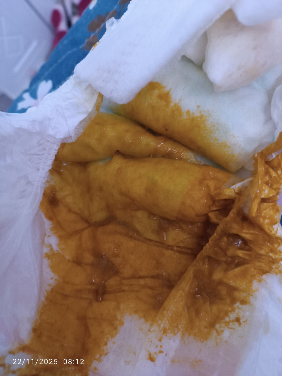 سرماخوردگی و اسهال که تمام نمیشه.