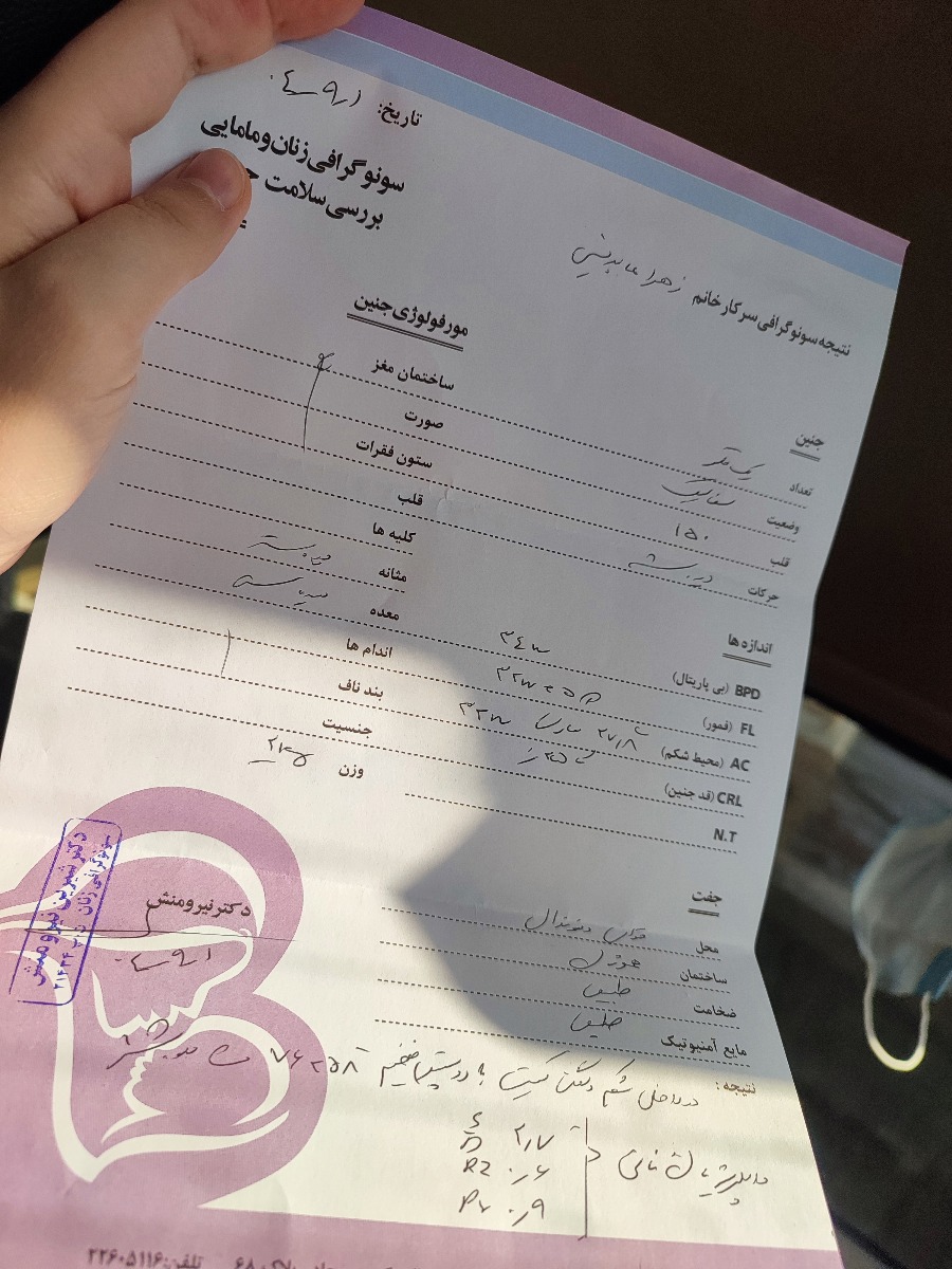 بزرگ تر شدن کیست تخمدان جنینم بزرگ تر شدن کیست تخمدان جنینم