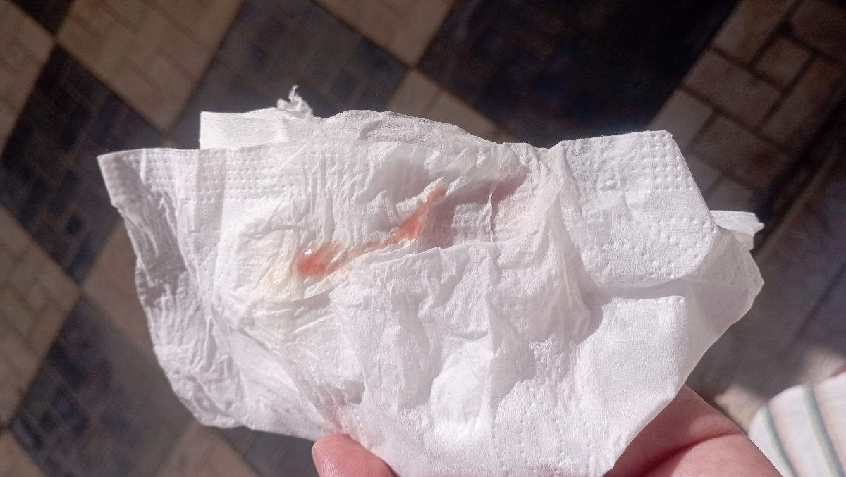 ترشحات بعد از استفاده از پماد