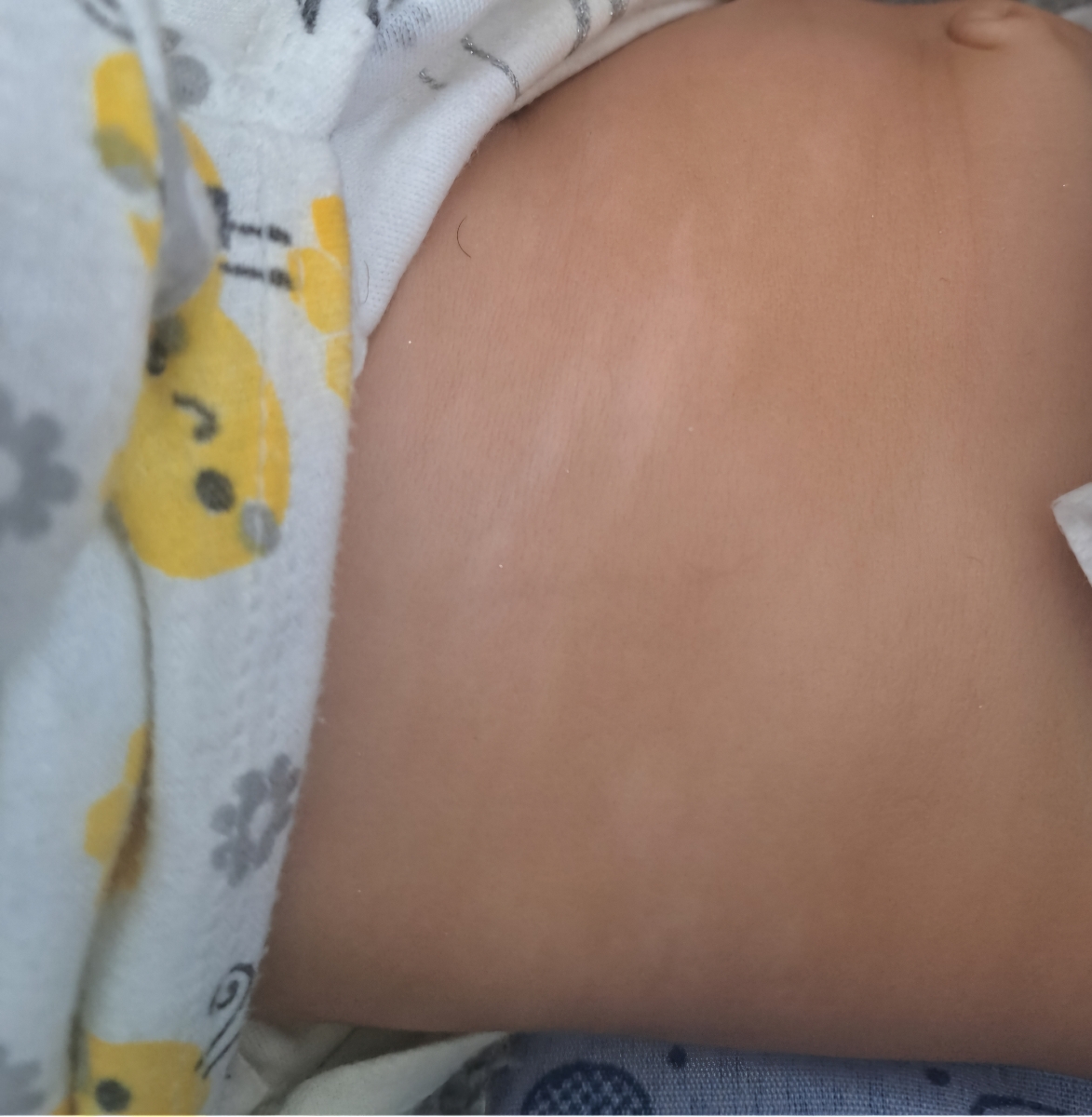 لک کم رنگ بدن نوزادی لک کم رنگ بدن نوزادی