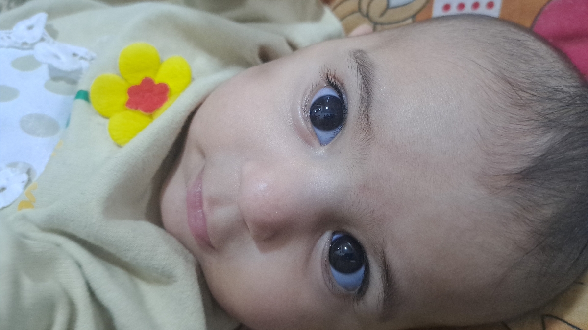 لک کم رنگ بدن نوزادی لک کم رنگ بدن نوزادی