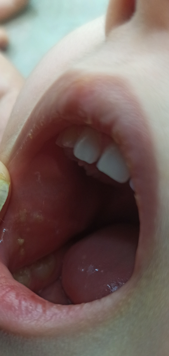 دونه های سفید چی هست دونه های سفید چی هست