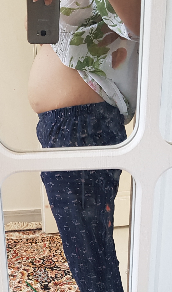 عکس شکم در هفته ۱۴ ...خیلی کوچیک نیست؟؟؟!!