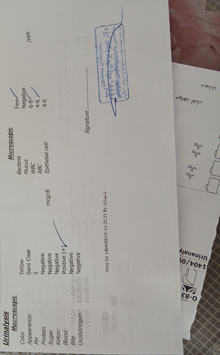 سردرد در بارداری هفته ۳۱