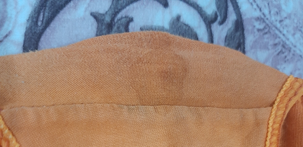 علائم عفونت ادراری بعد از مصرف داروها