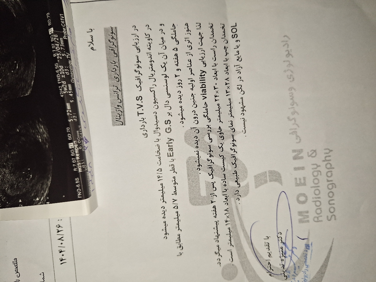 لکه بینی در بارداری لکه بینی در بارداری