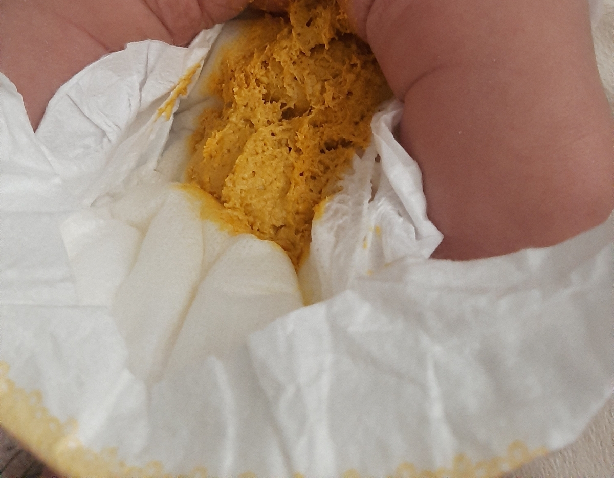 مدفوع نوزادم طبیعیه بنظرتون؟ مدفوع نوزادم طبیعیه بنظرتون؟