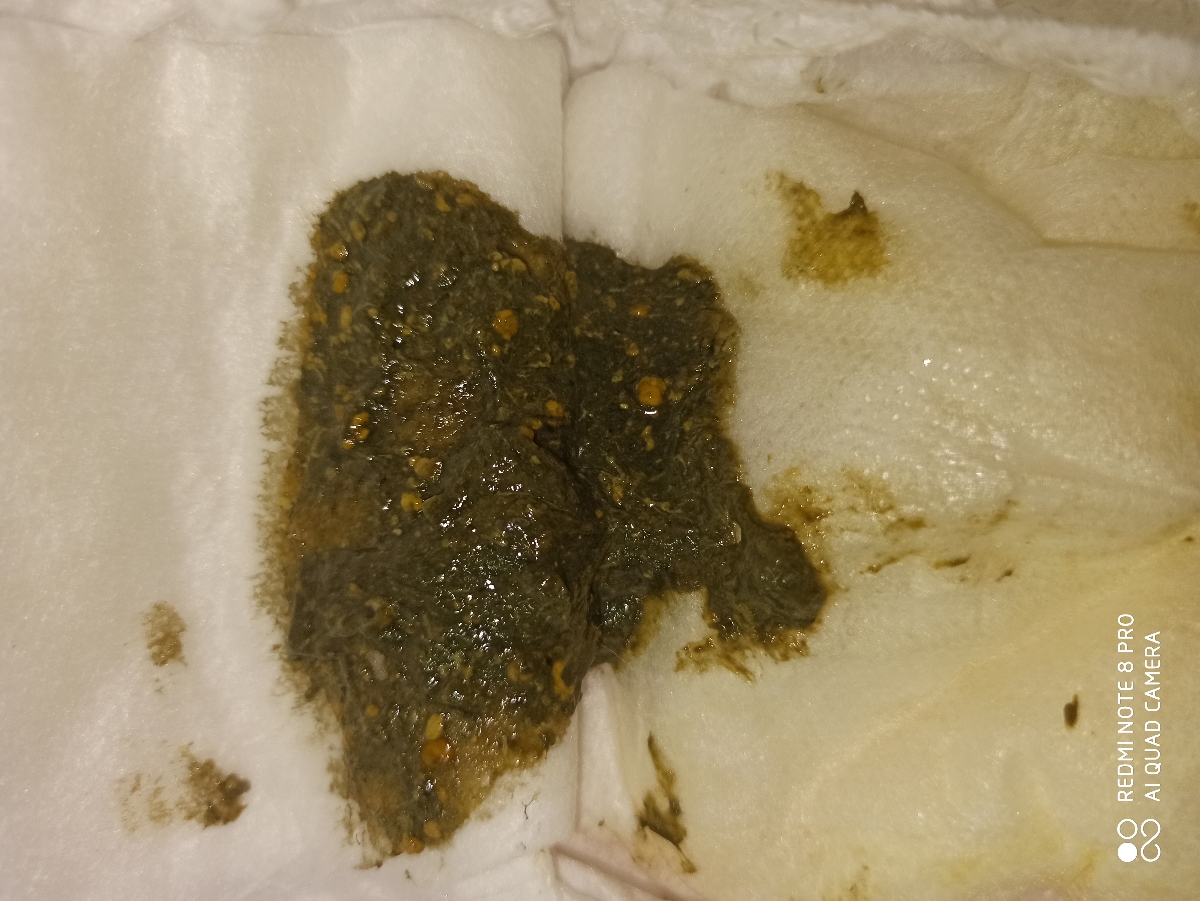 دکترجان ببخشید پی پی ش با شیرخشک گیگوز