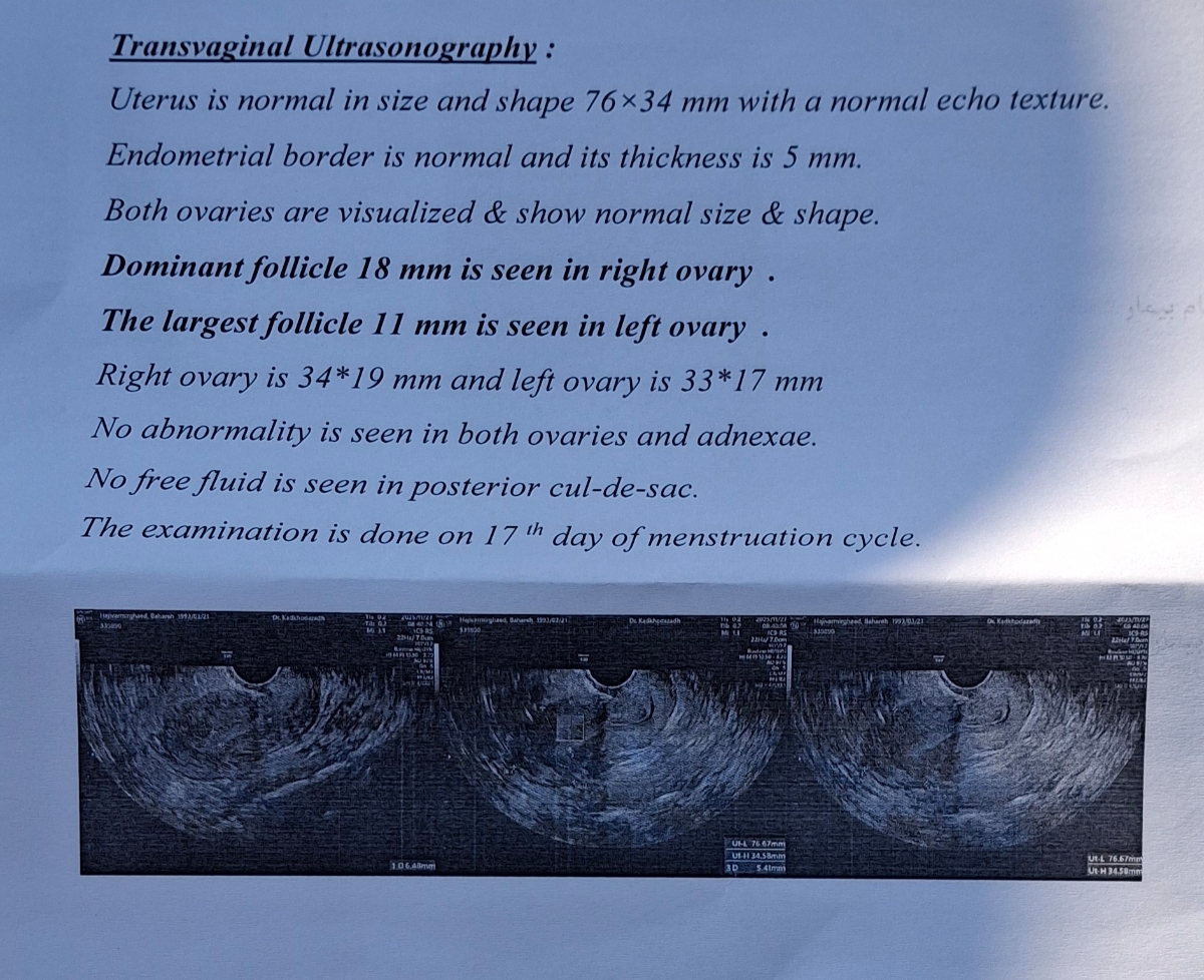 سونو روز ۱۷ سیکل همین ماه
دیروز صبح انجام دادم سونو روز ۱۷ سیکل همین ماه
دیروز صبح انجام دادم