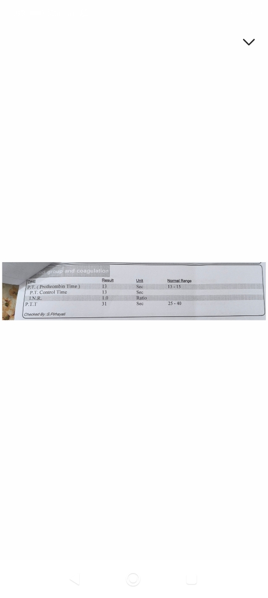 قرص هورمونی سیپروترون کامپاد