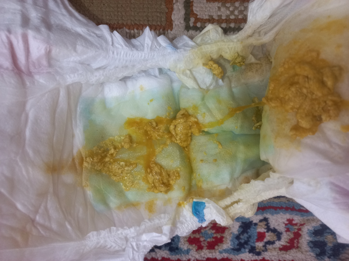 تب بالا ۳۹درجه دکترخواهشا جواب بدید