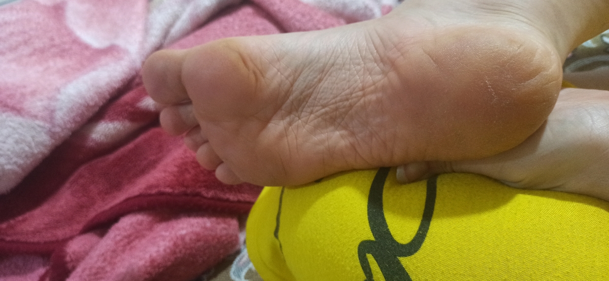 دردشدید پاشنه پا.........و درد بخیه