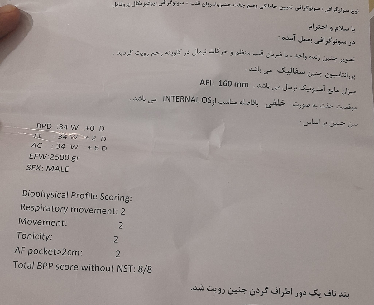 بند ناف یه دور اطراف گردن جنین