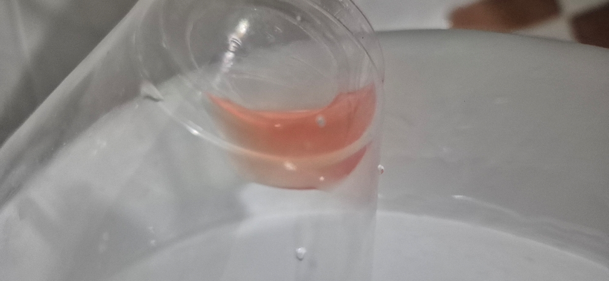 سوزش همراه با درد شدید موقع ادار