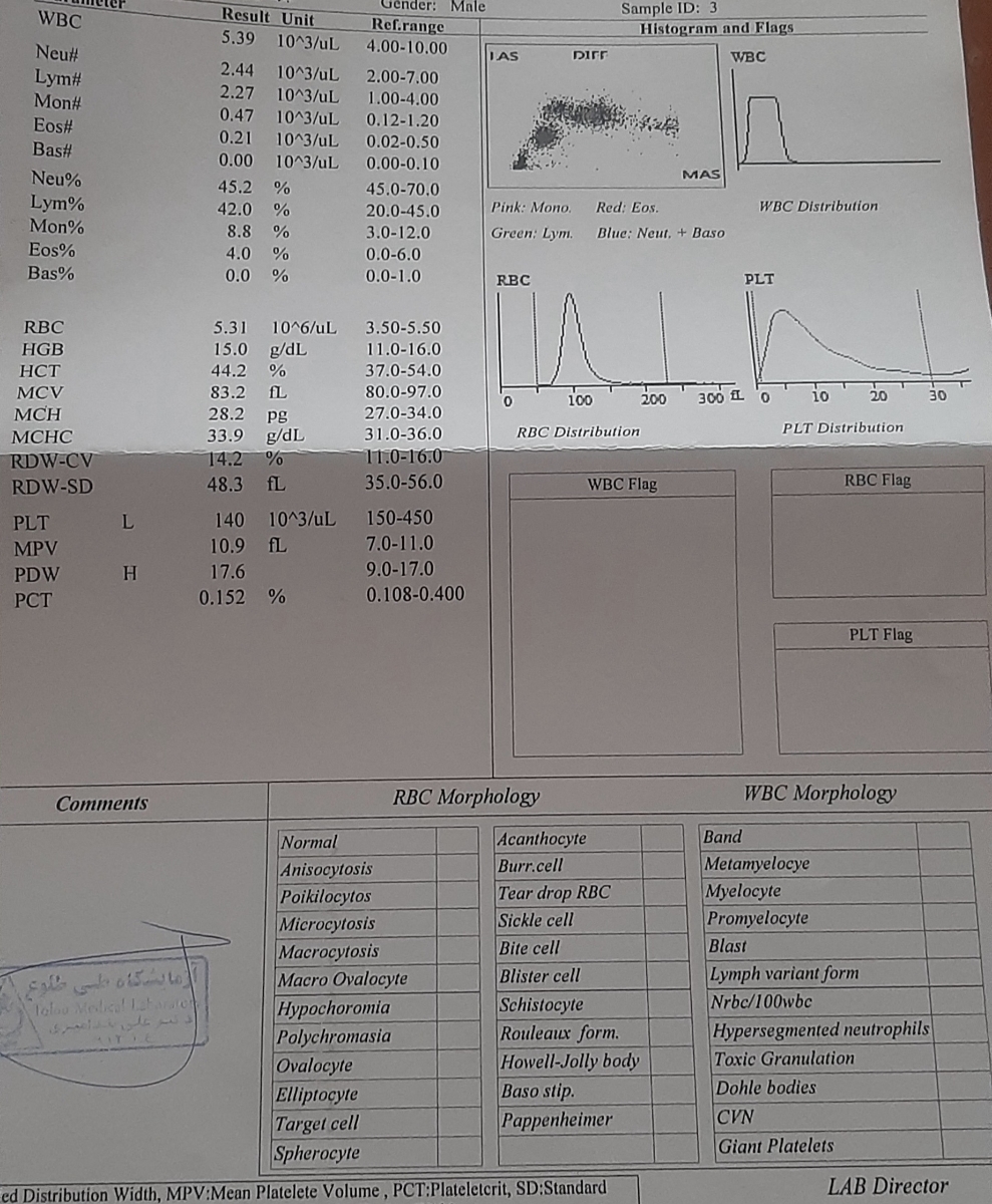 آزمایش دوم آزمایش دوم