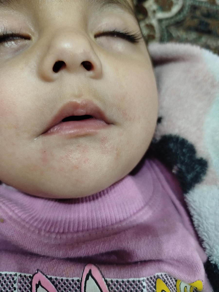 دون دون شدن پوست صورت