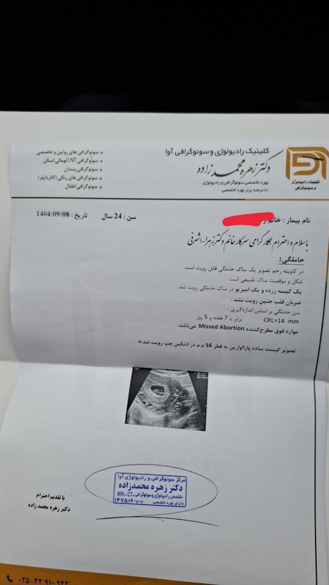 دارم سقط میکنم دارم سقط میکنم