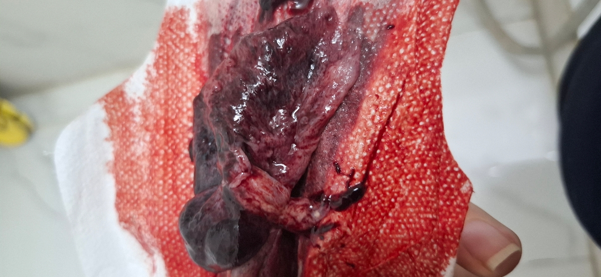 دارم سقط میکنم