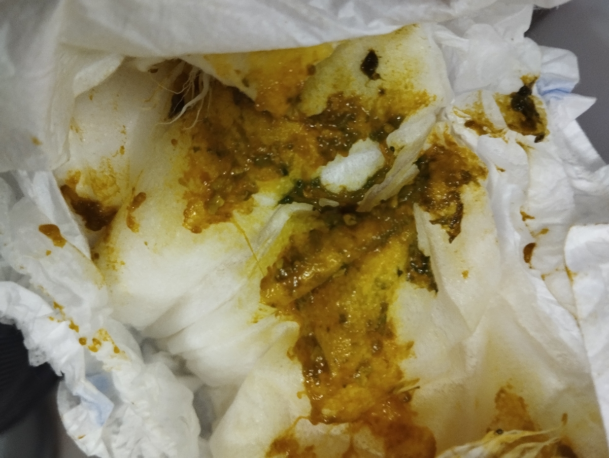 خس خس سینه نوزاد و عطسه زدن