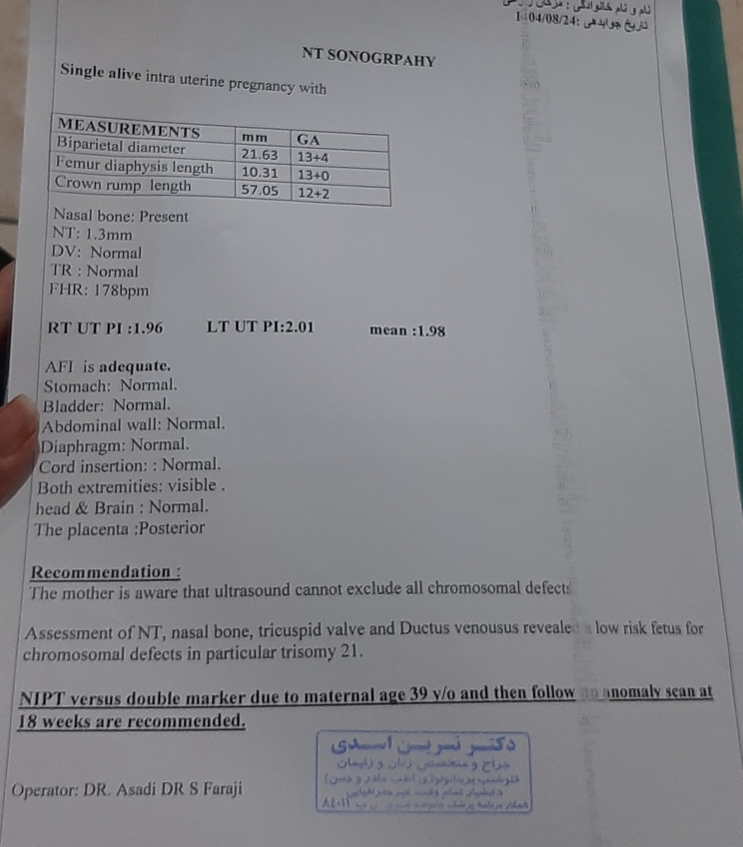 این سونو انتی این سونو انتی