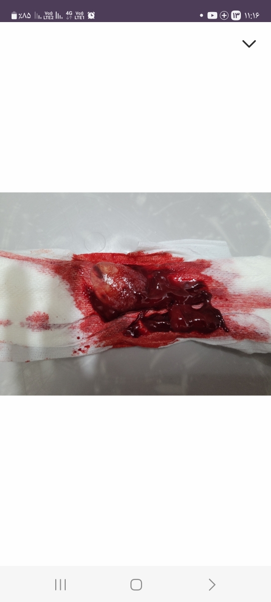 دارم سقط میکنم