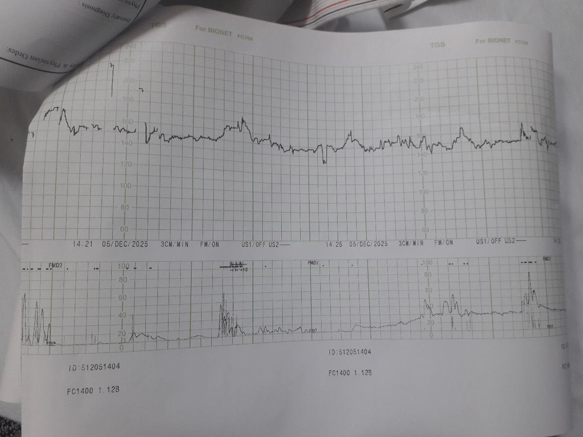 دکترجان بیزحمت تفسیر nst؟؟؟؟
