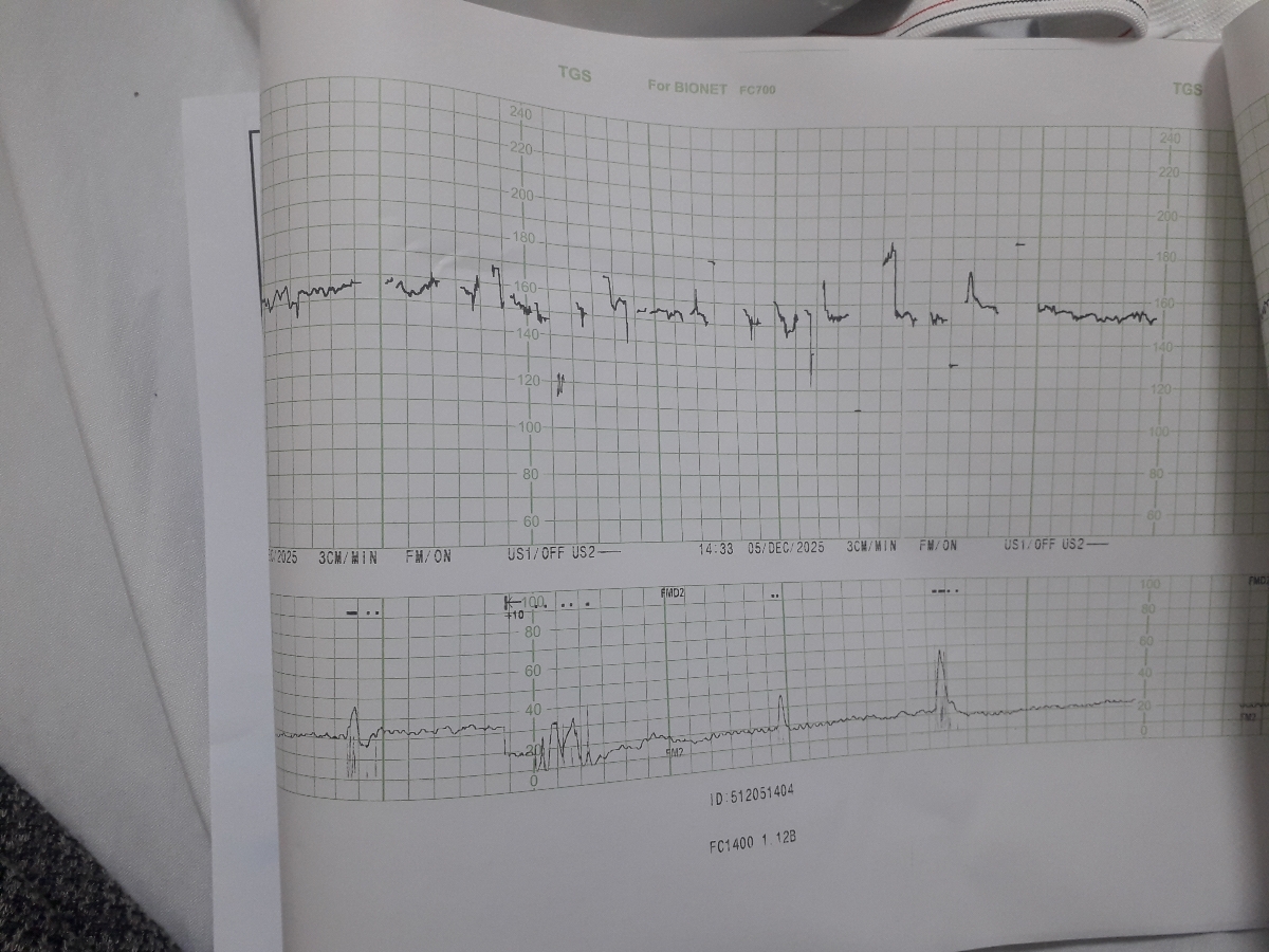 دکترجان بیزحمت تفسیر nst؟؟؟؟