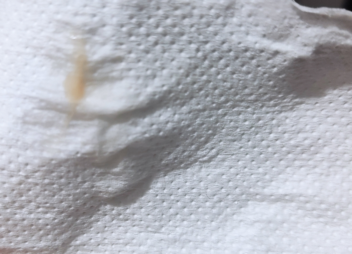 لکه بینیم در این حده نه بیشتر