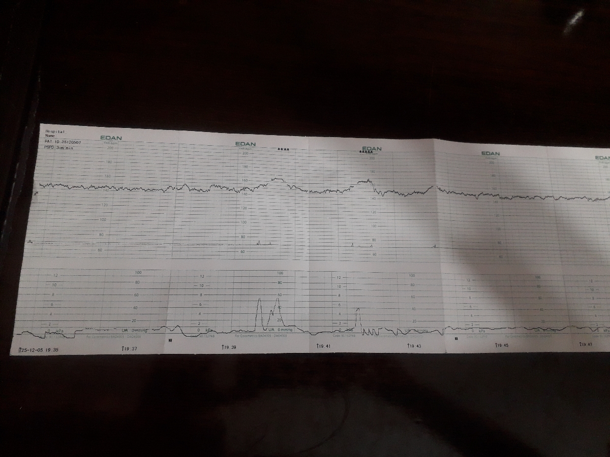 دکترجان بیزحمت تفسیر nst؟؟؟؟
