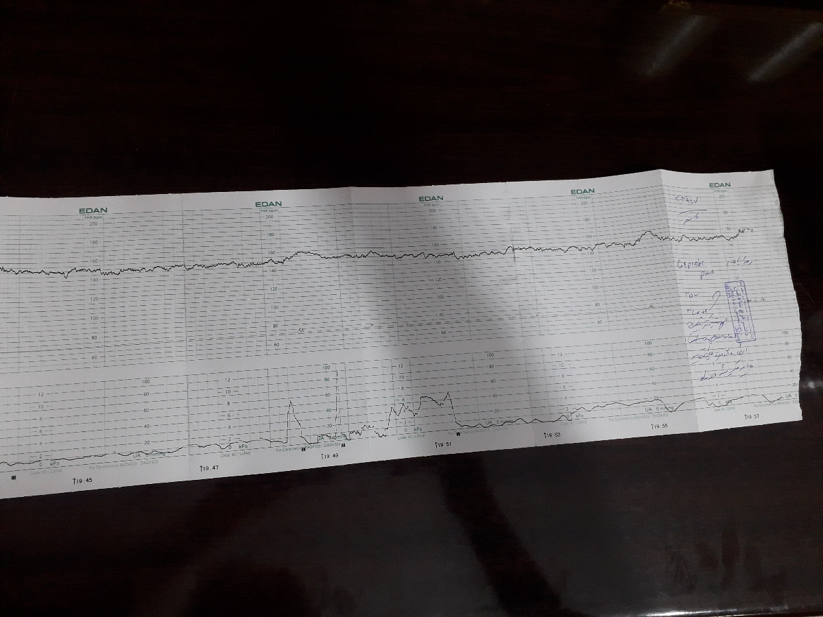 دکترجان بیزحمت تفسیر nst؟؟؟؟