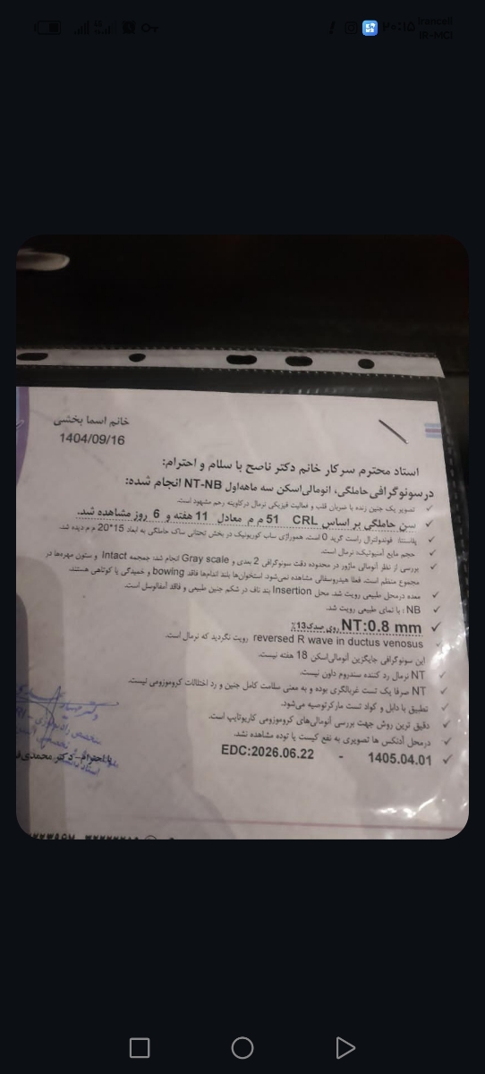 عدد ان تی باید چند باشد عدد ان تی باید چند باشد