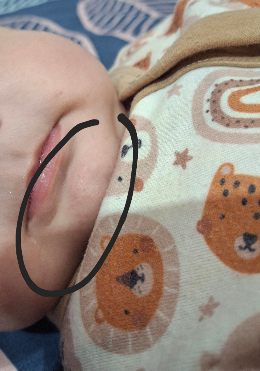 سرماخوردگی نوزاد ۵ ماهه😞 سرماخوردگی نوزاد ۵ ماهه😞