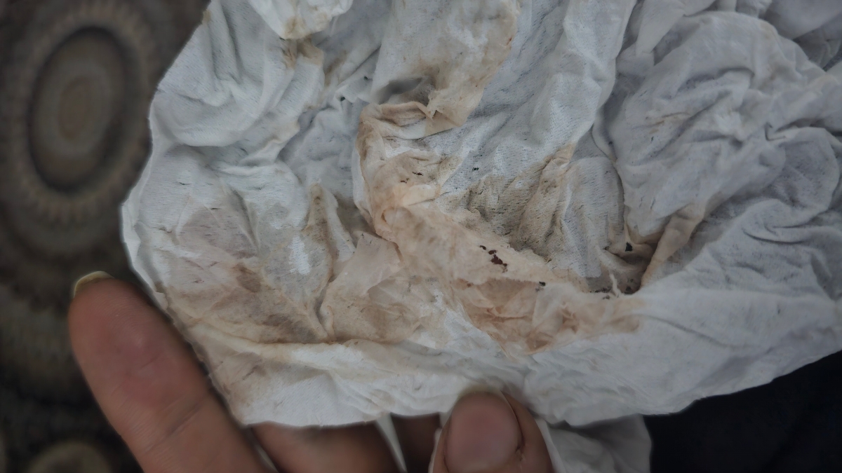 ترشح خونی ازم اومد هفته ششم هستم علتش چیه ترشح خونی ازم اومد هفته ششم هستم علتش چیه