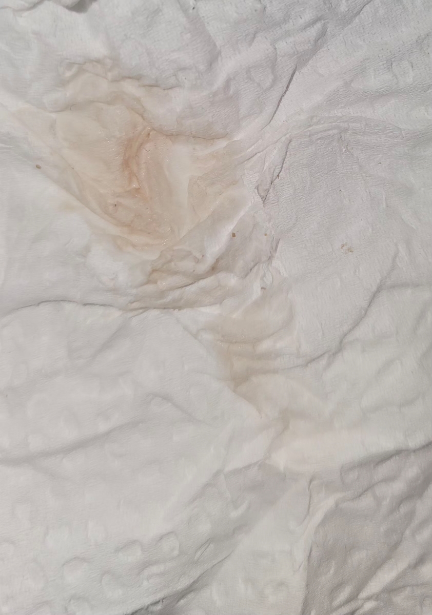 ترشح خونی ازم اومد هفته ششم هستم علتش چیه ترشح خونی ازم اومد هفته ششم هستم علتش چیه