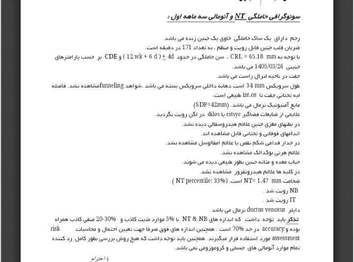 تفسیر سونو ان تی