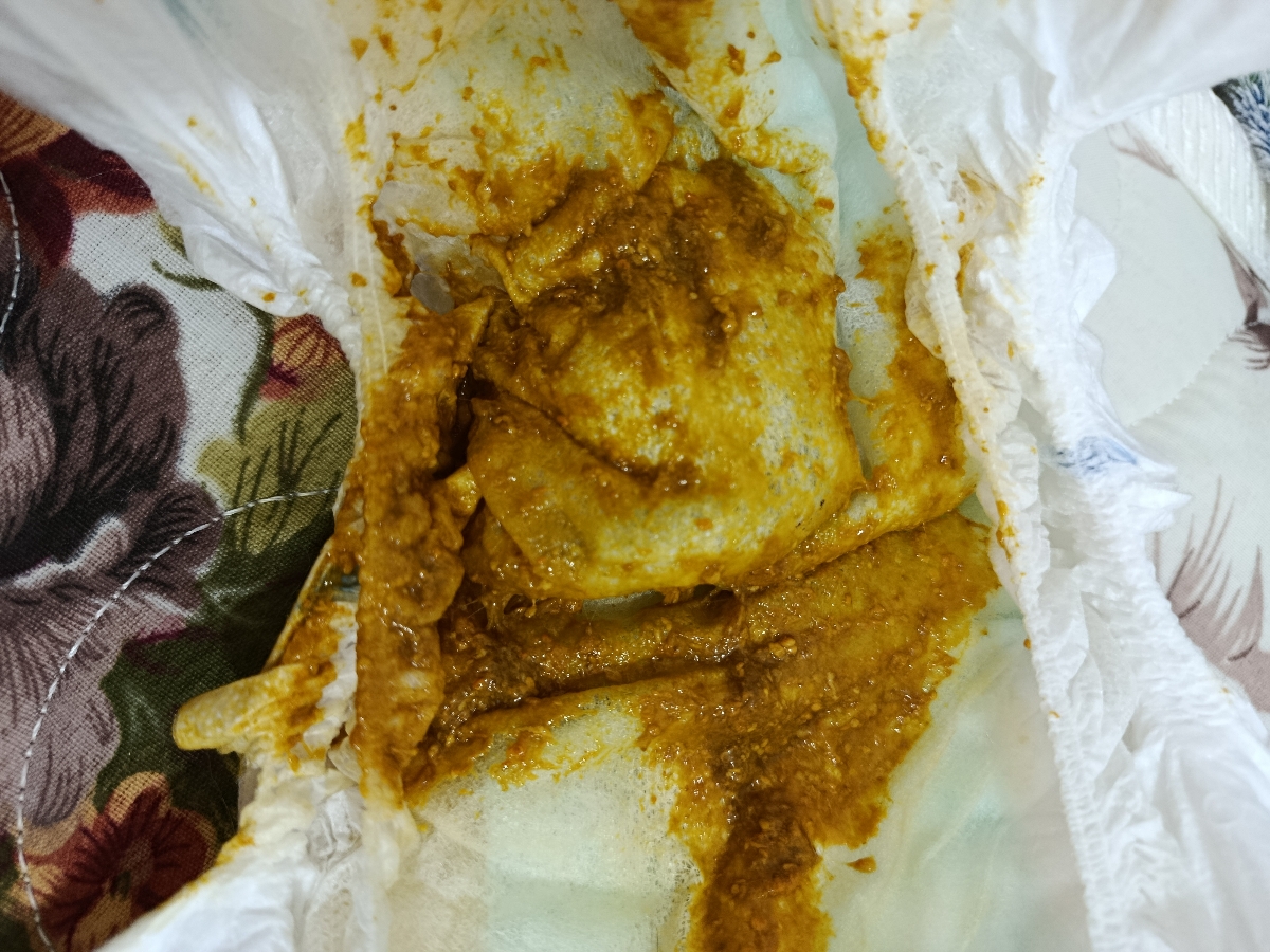 مدفوع زرد و آبکی نوزاد مدفوع زرد و آبکی نوزاد