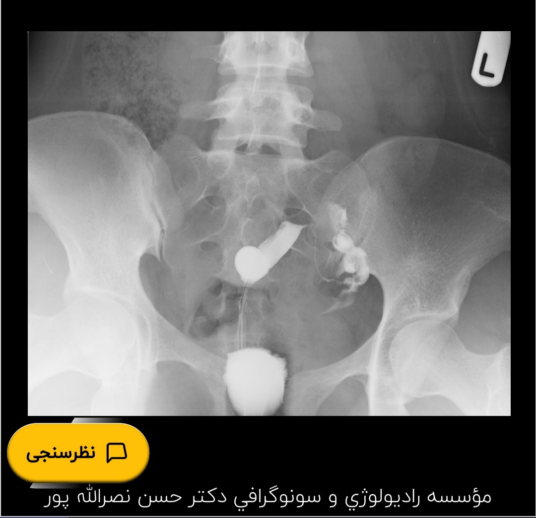 تفسیر عکس رنگی رحم تفسیر عکس رنگی رحم