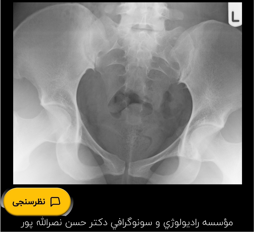 تفسیر عکس رنگی رحم تفسیر عکس رنگی رحم