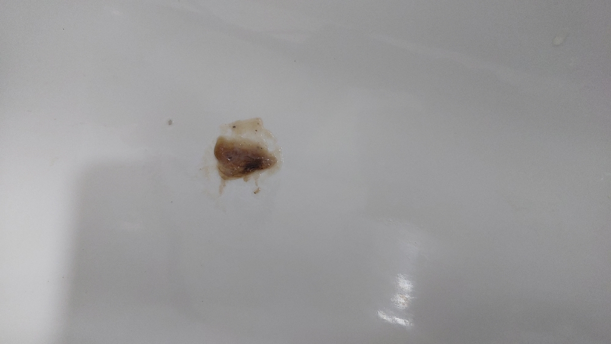 لکه بینی در هفته ۲۶ بارداری