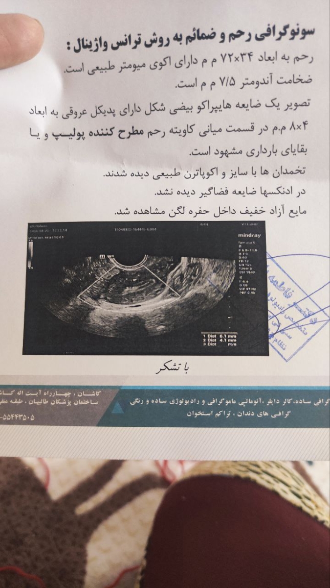 سقط خود خواسته و اثرات بعد سقط سقط خود خواسته و اثرات بعد سقط